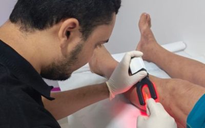 Pacientes relatam melhora após primeira sessão de tratamento de varizes no Cuidar Correntina